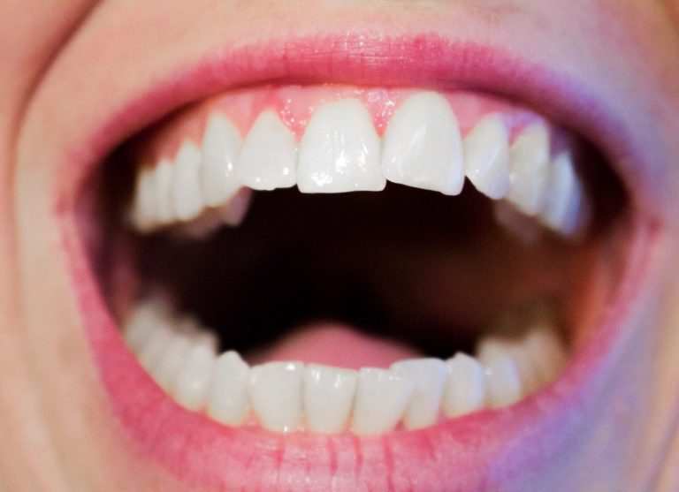 Dzisiejsza technika wykorzystywana w salonach stomatologii estetycznej być może sprawić, że odbierzemy prześliczny uśmiech.